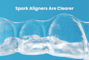 Spark Aligners
